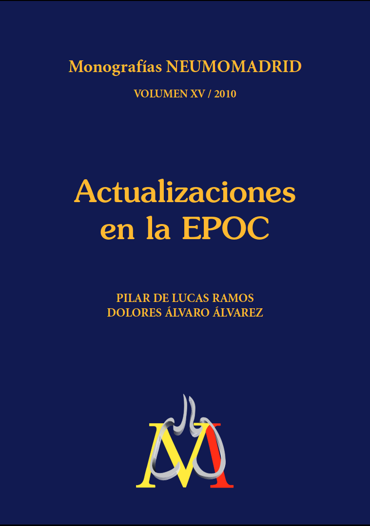 monografia-actualizaciones-en-la-EPOC